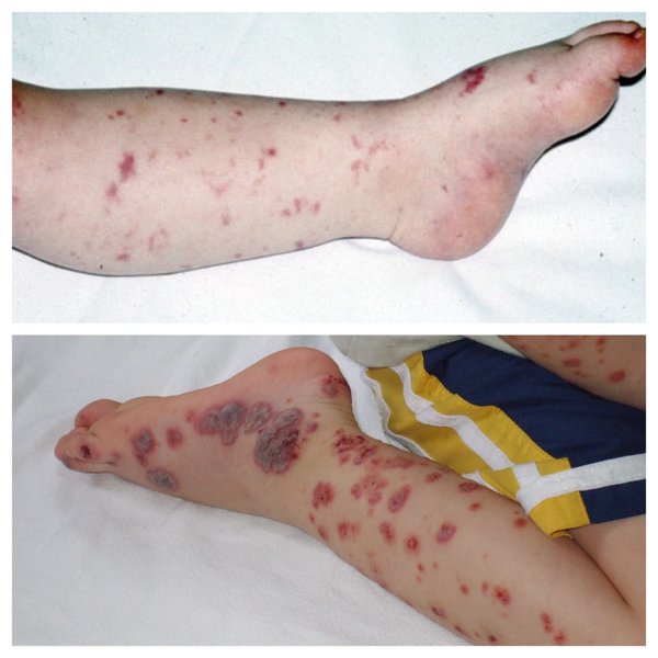 RT @fakethom: Top rash will definitely kill a chil…